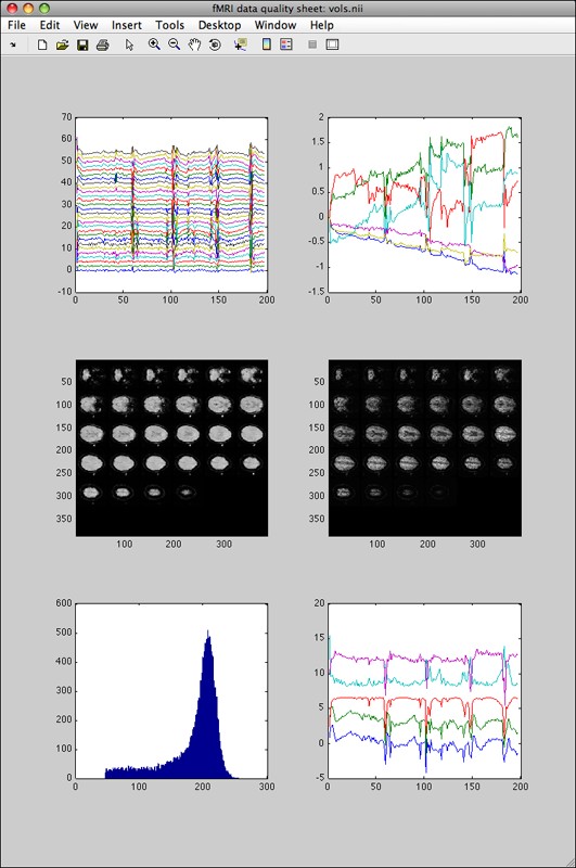 fmriqasheet output for a call to fmriquality with motion parameters detection