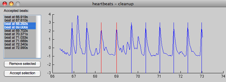 heartbeats cleanup dialog