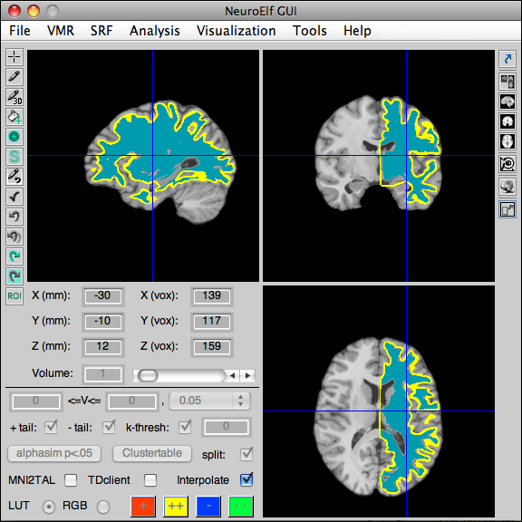 Back-projection of the ICBM-normalized left hemisphere of the colin dataset