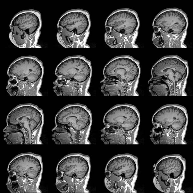 Structural image showing inhomogeneity