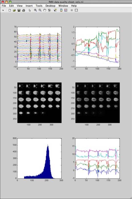 fmriqasheet_wmotion.jpg fmriqasheet_wmotion.jpg