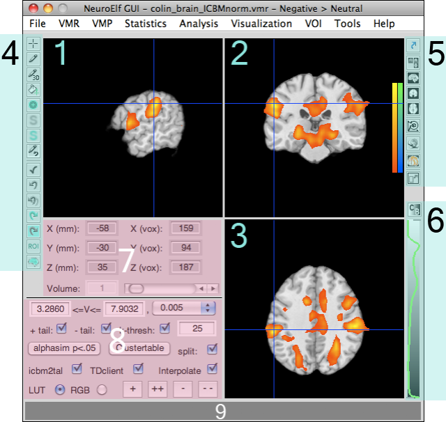 neuroelf_gui_minimized_v09c.png neuroelf_gui_minimized_v09c.png