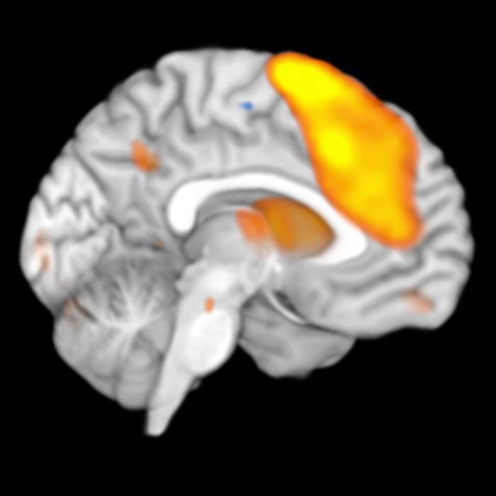 render_brain_activation_hemisphere.jpg render_brain_activation_hemisphere.jpg