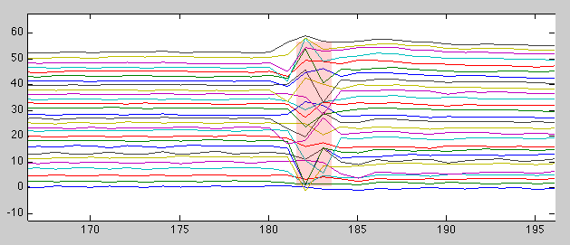 zoomed slice time courses