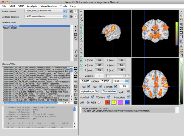 NeuroElf GUI (full mode with stats)