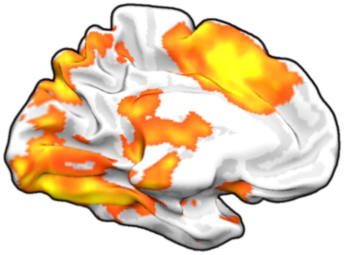 Surface projection sample