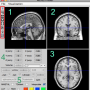 neuroelf_viewer_mini.png