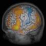 render_brain_transparentskull_activation.jpg