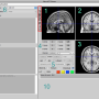 neuroelf_viewer.png